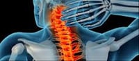 What is spinal stroke? Spinal Cord Stroke